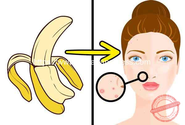 Banana-Peel-Reduce-Acne